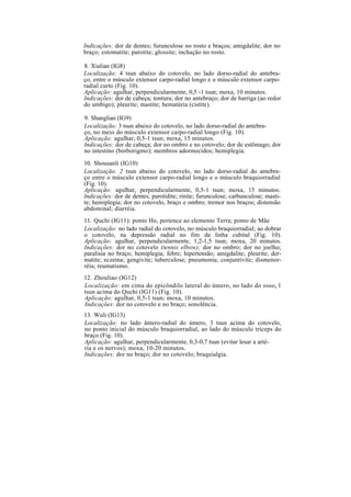 Indicações: dor de dentes; furunculose no rosto e braços; amigdalite; dor no
braço; estomatite; parotite; glossite; inchação no rosto.
8. Xialian (IG8)
Localização: 4 tsun abaixo do cotovelo, no lado dorso-radial do antebra-
ço, entre o músculo extensor carpo-radial longo e o músculo extensor carpo-
radial curto (Fig. 10).
Aplicação: agulhar, perpendicularmente, 0,5 -1 tsun; moxa, 10 minutos.
Indicações: dor de cabeça; tontura; dor no antebraço; dor de barriga (ao redor
do umbigo); pleurite; mastite; hematúria (cistite).
9. Shanglian (IG9)
Localização: 3 tsun abaixo do cotovelo, no lado dorso-radial do antebra-
ço, no meio do músculo extensor carpo-radial longo (Fig. 10).
Aplicação: agulhar, 0,5-1 tsun; moxa, 15 minutos.
Indicações: dor de cabeça; dor no ombro e no cotovelo; dor de estômago; dor
no intestino (borborigmo); membros adormecidos; hemiplegia.
10. Shousanli (IG10)
Localização: 2 tsun abaixo do cotovelo, no lado dorso-radial do antebra-
ço entre o músculo extensor carpo-radial longo e o músculo braquiorradial
(Fig. 10).
Aplicação: agulhar, perpendicularmente, 0,5-1 tsun; moxa, 15 minutos.
Indicações: dor de dentes; parotidite; rinite; furunculose; carbunculose; masti-
te; hemiplegia; dor no cotovelo, braço e ombro; tremor nos braços; distensão
abdominal; diarréia.
11. Quchi (IG11): ponto Ho, pertence ao elemento Terra; ponto de Mãe
Localização: no lado radial do cotovelo, no músculo braquiorradial; ao dobrar
o cotovelo, na depressão radial no fim da linha cubital (Fig. 10).
Aplicação: agulhar, perpendicularmente, 1,2-1,5 tsun; moxa, 20 minutos.
Indicações: dor no cotovelo (tennis elbow); dor no ombro; dor no joelho;
paralisia no braço; hemiplegia; febre; hipertensão; amigdalite; pleurite; der-
matite; eczema; gengivite; tuberculose; pneumonia; conjuntivite; dismenor-
réia; reumatismo.
12. Zhouliao (IG12)
Localização: em cima do epicôndilo lateral do úmero, no lado do osso, l
tsun acima do Quchi (IG11) (Fig. 10).
Aplicação: agulhar, 0,5-1 tsun; moxa, 10 minutos.
Indicações: dor no cotovelo e no braço; sonolência.
13. Wuli (IG13)
Localização: no lado ântero-radial do úmero, 3 tsun acima do cotovelo,
no ponto inicial do músculo braquiorradial, ao lado do músculo tríceps do
braço (Fig. 10).
Aplicação: agulhar, perpendicularmente, 0,3-0,7 tsun (evitar lesar a arté-
ria e os nervos); moxa, 10-20 minutos.
Indicações: dor no braço; dor no cotovelo; braquialgia.
 