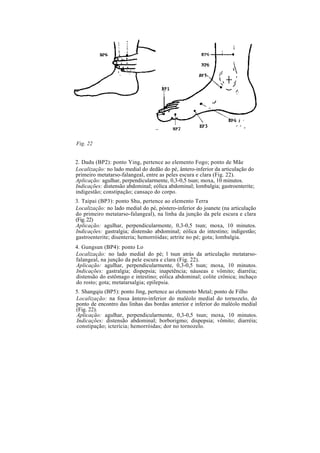 Fig. 22
2. Dadu (BP2): ponto Ying, pertence ao elemento Fogo; ponto de Mãe
Localização: no lado medial do dedão do pé, ântero-inferior da articulação do
primeiro metatarso-falangeal, entre as peles escura e clara (Fig. 22).
Aplicação: agulhar, perpendicularmente, 0,3-0,5 tsun; moxa, 10 minutos.
Indicações: distensão abdominal; eólica abdominal; lombalgia; gastroenterite;
indigestão; constipação; cansaço do corpo.
3. Taipai (BP3): ponto Shu, pertence ao elemento Terra
Localização: no lado medial do pé, póstero-inferior do joanete (na articulação
do primeiro metatarso-falangeal), na linha da junção da pele escura e clara
(Fig.22)
Aplicação: agulhar, perpendicularmente, 0,3-0,5 tsun; moxa, 10 minutos.
Indicações: gastralgia; distensão abdominal; eólica do intestino; indigestão;
gastroenterite; disenteria; hemorróidas; artrite no pé; gota; lombalgia.
4. Gungsun (BP4): ponto Lo
Localização: no lado medial do pé; l tsun atrás da articulação metatarso-
falangeal, na junção da pele escura e clara (Fig. 22).
Aplicação: agulhar, perpendicularmente, 0,3-0,5 tsun; moxa, 10 minutos.
Indicações: gastralgia; dispepsia; inapetência; náuseas e vômito; diarréia;
distensão do estômago e intestino; eólica abdominal; colite crônica; inchaço
do rosto; gota; metatarsalgia; epilepsia.
5. Shangqiu (BP5): ponto Jing, pertence ao elemento Metal; ponto de Filho
Localização: na fossa ântero-inferior do maléolo medial do tornozelo, do
ponto de encontro das linhas das bordas anterior e inferior do maléolo medial
(Fig. 22).
Aplicação: agulhar, perpendicularmente, 0,3-0,5 tsun; moxa, 10 minutos.
Indicações: distensão abdominal; borborigmo; dispepsia; vômito; diarréia;
constipação; icterícia; hemorróidas; dor no tornozelo.
 