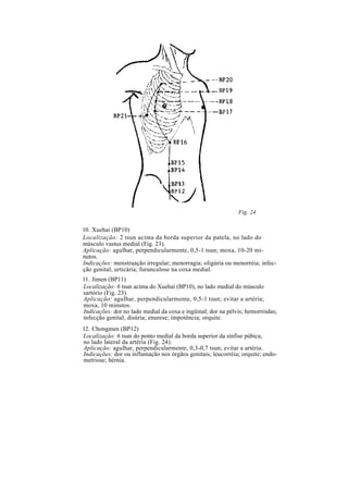 Fig. 24
10. Xuehai (BP10)
Localização: 2 tsun acima da borda superior da patela, no lado do
músculo vastus medial (Fig. 23).
Aplicação: agulhar, perpendicularmente, 0,5-1 tsun; moxa, 10-20 mi-
nutos.
Indicações: menstruação irregular; menorragia; oligúria ou menorréia; infec-
ção genital; urticária; furunculose na coxa medial.
11. Jimen (BP11)
Localização: 6 tsun acima do Xuehai (BP10), no lado medial do músculo
sartório (Fig. 23).
Aplicação: agulhar, perpendicularmente, 0,5-1 tsun; evitar a artéria;
moxa, 10 minutos.
Indicações: dor no lado medial da coxa e ingüinal; dor na pélvis; hemorróidas;
infecção genital; disúria; enurese; impotência; orquite.
12. Chongmen (BP12)
Localização: 6 tsun do ponto medial da borda superior da sínfise púbica,
no lado lateral da artéria (Fig. 24).
Aplicação: agulhar, perpendicularmente, 0,3-0,7 tsun; evitar a artéria.
Indicações: dor ou inflamação nos órgãos genitais; leucorréia; orquite; endo-
metriose; hérnia.
 