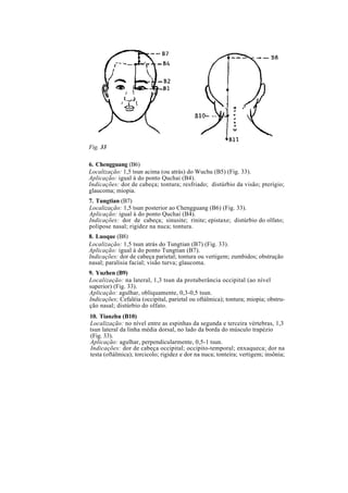Fig. 33
6. Chengguang (B6)
Localização: 1,5 tsun acima (ou atrás) do Wuchu (B5) (Fig. 33).
Aplicação: igual à do ponto Quchai (B4).
Indicações: dor de cabeça; tontura; resfriado; distúrbio da visão; pterígio;
glaucoma; miopia.
7. Tungtian (B7)
Localização: 1,5 tsun posterior ao Chengguang (B6) (Fig. 33).
Aplicação: igual à do ponto Quchai (B4).
Indicações: dor de cabeça; sinusite; rinite; epistaxe; distúrbio do olfato;
polipose nasal; rigidez na nuca; tontura.
8. Luoque (B8)
Localização: 1,5 tsun atrás do Tungtian (B7) (Fig. 33).
Aplicação: igual à do ponto Tungtian (B7).
Indicações: dor de cabeça parietal; tontura ou vertigem; zumbidos; obstrução
nasal; paralisia facial; visão turva; glaucoma.
9. Yuzhen (B9)
Localização: na lateral, 1,3 tsun da protuberância occipital (ao nível
superior) (Fig. 33).
Aplicação: agulhar, obliquamente, 0,3-0,5 tsun.
Indicações; Cefaléia (occipital, parietal ou oftálmica); tontura; miopia; obstru-
ção nasal; distúrbio do olfato.
10. Tianzhu (B10)
Localização: no nível entre as espinhas da segunda e terceira vértebras, 1,3
tsun lateral da linha média dorsal, no lado da borda do músculo trapézio
(Fig. 33).
Aplicação: agulhar, perpendicularmente, 0,5-1 tsun.
Indicações: dor de cabeça occipital; occipito-temporal; enxaqueca; dor na
testa (oftálmica); torcicolo; rigidez e dor na nuca; tonteira; vertigem; insônia;
 