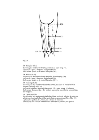 Fig. 35
33. Zongliao (B33)
Localização: no terceiro forame posterior do sacro (Fig. 34).
Aplicação: igual à do ponto Shangliao (B31).
Indicações: iguais às do ponto Shangliao (B31).
34. Xialiao (B34)
Localização: no quarto forame posterior do sacro (Fig. 34).
Aplicação: igual à do ponto Shangliao (B31).
Indicações: iguais às do ponto Shangliao (B31).
35. Huiyang (B35)
Localização: 0,5 tsun lateral da linha central, no nível da borda inferior
do osso coccígeo (Fig. 34).
Aplicação: agulhar, perpendicularmente, 1-1,5 tsun; moxa, 10 minutos.
Indicações: dismenorréia e dor lombar; leucorréia; impotência; hemorróidas;
dor na perna.
36. Chengfu (B36)
Localização: no ponto médio da linha glútea; na borda inferior do músculo
glúteo máximo; na linha média vertical da coxa posterior (Figs. 34 e 35).
Aplicação: agulhar, 1-1,5 tsun, até a fáscia do músculo.
Indicações: dor ciática; hemorróidas; constipação; disúria; dor genital.
 