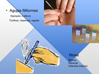 • Agujas filiformes
Moxa
Diametro: 0.26mm
Tonificar, dispersar, regular
Directa
Indirecta
Artemisa (hierba)
 