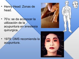 • Henry Head: Zonas de
head.
• 70’s: se da aconocer la
utilización de la
acupuntura en anestesia
quirurgica.
• 1979: OMS recomienda la
acupuntura.
 