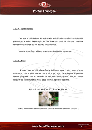 AN02FREV001/REV 4.0
74
3.3.3.1.3 Ventosaterapia
Na face, a utilização da ventosa auxilia a diminuição de linhas de expressão
por meio do aumento na produção de Xue. Para isso, deve ser realizado um suave
deslizamento na área, por no máximo cinco minutos.
Importante: na face, utilizam-se ventosas de plástico, pequenas.
3.3.3.1.4 Moxa
A moxa deve ser utilizada de forma deslizante sobre o sulco ou ruga a ser
amenizada, com a finalidade de aumentar a produção de colágeno. Importante
sempre perguntar para o paciente se não está muito quente, pois se houver
descuido do acupunturista a moxa pode queimar a pele do paciente.
FIGURA 24 – APLICAÇÃO DE MOXA FACIAL
FONTE: Disponível em: <www.bioelemento.com.br/acuestetica>. Acesso em:14/12/2011.
 