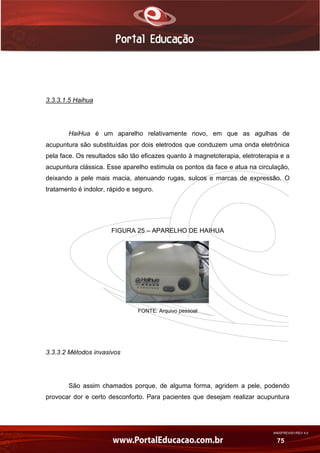 AN02FREV001/REV 4.0
75
3.3.3.1.5 Haihua
HaiHua é um aparelho relativamente novo, em que as agulhas de
acupuntura são substituídas por dois eletrodos que conduzem uma onda eletrônica
pela face. Os resultados são tão eficazes quanto à magnetoterapia, eletroterapia e a
acupuntura clássica. Esse aparelho estimula os pontos da face e atua na circulação,
deixando a pele mais macia, atenuando rugas, sulcos e marcas de expressão. O
tratamento é indolor, rápido e seguro.
FIGURA 25 – APARELHO DE HAIHUA
FONTE: Arquivo pessoal
3.3.3.2 Métodos invasivos
São assim chamados porque, de alguma forma, agridem a pele, podendo
provocar dor e certo desconforto. Para pacientes que desejam realizar acupuntura
 