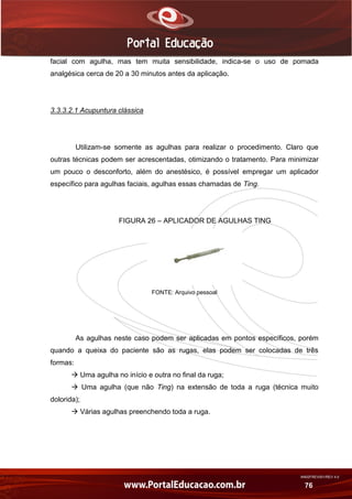 AN02FREV001/REV 4.0
76
facial com agulha, mas tem muita sensibilidade, indica-se o uso de pomada
analgésica cerca de 20 a 30 minutos antes da aplicação.
3.3.3.2.1 Acupuntura clássica
Utilizam-se somente as agulhas para realizar o procedimento. Claro que
outras técnicas podem ser acrescentadas, otimizando o tratamento. Para minimizar
um pouco o desconforto, além do anestésico, é possível empregar um aplicador
específico para agulhas faciais, agulhas essas chamadas de Ting.
FIGURA 26 – APLICADOR DE AGULHAS TING
FONTE: Arquivo pessoal
As agulhas neste caso podem ser aplicadas em pontos específicos, porém
quando a queixa do paciente são as rugas, elas podem ser colocadas de três
formas:
 Uma agulha no início e outra no final da ruga;
 Uma agulha (que não Ting) na extensão de toda a ruga (técnica muito
dolorida);
 Várias agulhas preenchendo toda a ruga.
 