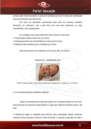 AN02FREV001/REV 4.0
78
sempre pelo mesmo paciente, e pode ser reutilizado por ele. O tempo de reutilização
varia de fabricante para fabricante.
Ele deve ser deslizado suavemente pela pele em diversos sentidos,
formando um “asterisco”, até a pele ficar com uma leve hiperemia, ou seja,
vermelhidão e não sangramento.
As vantagens para esse tratamento são inúmeras, entre elas:
 Cicatrização rápida (menos de uma hora).
 Desaparecimento da vermelhidão em menos de 24 horas.
 Média de três sessões para o resultado ser visível.
Essa técnica deve ser realizada uma vez por mês, no mínimo.
FIGURA 28 – DERMAROLLER
FONTE: Disponível em: <http://dramonicalinhares.blogspot.com>. Acesso em: 14/12/2011.
3.3.4 Complementação do Método Utilizado
Todos os procedimentos descritos podem ser complementados um ao outro.
Duas técnicas em particular potencializam a ação dos métodos descritos acima, são
elas:
 Peeling de Algas: é realizado para diminuir acne, oleosidade, clarear manchas,
melhorar textura da pele e diminuir sinais do tempo. O peeling é aplicado em todo o
 
