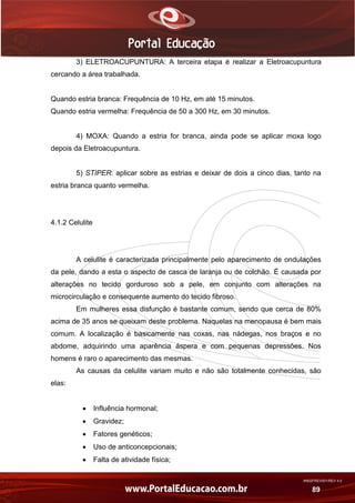 AN02FREV001/REV 4.0
89
3) ELETROACUPUNTURA: A terceira etapa é realizar a Eletroacupuntura
cercando a área trabalhada.
Quando estria branca: Frequência de 10 Hz, em até 15 minutos.
Quando estria vermelha: Frequência de 50 a 300 Hz, em 30 minutos.
4) MOXA: Quando a estria for branca, ainda pode se aplicar moxa logo
depois da Eletroacupuntura.
5) STIPER: aplicar sobre as estrias e deixar de dois a cinco dias, tanto na
estria branca quanto vermelha.
4.1.2 Celulite
A celulite é caracterizada principalmente pelo aparecimento de ondulações
da pele, dando a esta o aspecto de casca de laranja ou de colchão. É causada por
alterações no tecido gorduroso sob a pele, em conjunto com alterações na
microcirculação e consequente aumento do tecido fibroso.
Em mulheres essa disfunção é bastante comum, sendo que cerca de 80%
acima de 35 anos se queixam deste problema. Naquelas na menopausa é bem mais
comum. A localização é basicamente nas coxas, nas nádegas, nos braços e no
abdome, adquirindo uma aparência áspera e com pequenas depressões. Nos
homens é raro o aparecimento das mesmas.
As causas da celulite variam muito e não são totalmente conhecidas, são
elas:
 Influência hormonal;
 Gravidez;
 Fatores genéticos;
 Uso de anticoncepcionais;
 Falta de atividade física;
 