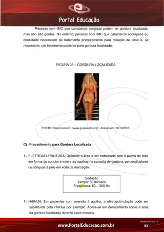 AN02FREV001/REV 4.0
93
Pessoas com IMC que caracteriza magreza podem ter gordura localizada,
mas não são gordas. No entanto, pessoas com IMC que caracteriza sobrepeso ou
obesidade necessitam de tratamento primeiramente para redução de peso e, se
necessário, um tratamento posterior para gordura localizada.
FIGURA 35 – GORDURA LOCALIZADA
FONTE: Disponível em: <www.guiasaude.org>. Acesso em: 06/10/2011.
C) Procedimento para Gordura Localizada
1) ELETROACUPUNTURA: Delimitar a área a ser trabalhada com a palma da mão
em forma de concha e inserir as agulhas na camada de gordura, perpendiculares
ou oblíquas à pele em volta da marcação.
1) HAIHUA: Em pacientes com aversão à agulha, a eletroestimulação pode ser
substituída pelo HaiHua por exemplo. Aplica-se em deslizamento sobre a área
da gordura localizada durante cinco minutos.
Sedação
Tempo: 30 minutos
Frequência: 50 – 300 Hz
 