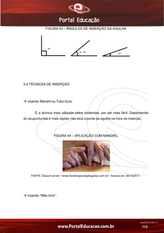 AN02FREV001/REV 4.0
114
FIGURA 43 – ÂNGULOS DE INSERÇÃO DA AGULHA
5.4 TÉCNICAS DE INSERÇÃO
 Usando Mandril ou Tubo Guia:
É a técnica mais utilizada pelos ocidentais, por ser mais fácil. Dependendo
do acupunturista é mais rápida, não toca a ponta da agulha na hora da inserção.
FIGURA 44 – APLICAÇÃO COM MANDRIL
FONTE: Disponível em: <www.fisioterapeutasplugadas.com.br>. Acesso em: 06/10/2011.
 Usando “Mão livre”:
 