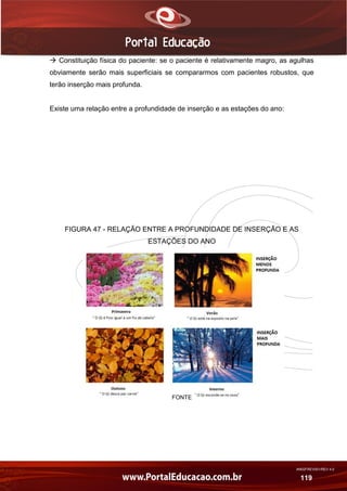 AN02FREV001/REV 4.0
119
 Constituição física do paciente: se o paciente é relativamente magro, as agulhas
obviamente serão mais superficiais se compararmos com pacientes robustos, que
terão inserção mais profunda.
Existe uma relação entre a profundidade de inserção e as estações do ano:
FIGURA 47 - RELAÇÃO ENTRE A PROFUNDIDADE DE INSERÇÃO E AS
ESTAÇÕES DO ANO
FONTE
 