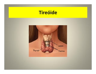 Tireóide
 