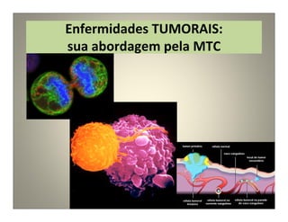 Enfermidades TUMORAIS:
sua abordagem pela MTC
 