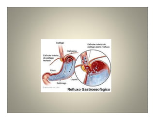 Acupuntura metabolica e chacras