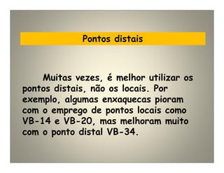 Pontos distais
Muitas vezes, é melhor utilizar os
pontos distais, não os locais. Por
exemplo, algumas enxaquecas pioram
com o emprego de pontos locais como
VB-14 e VB-20, mas melhoram muito
com o ponto distal VB-34.
 