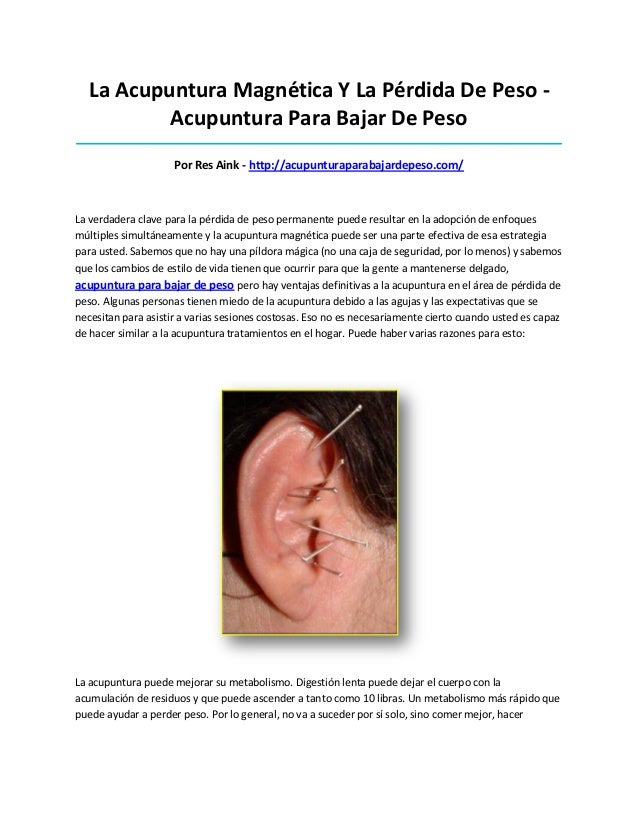 Acupuntura para bajar de peso