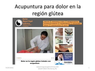 Acupuntura para dolor en la
región glútea
07/07/2016 1
www.drmiguelangelcontreras.com
(81)83728021 Monterrey, NL
 