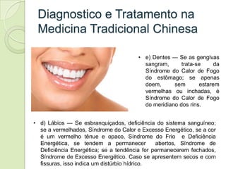 Diagnostico e Tratamento na
 Medicina Tradicional Chinesa

                                       • e) Dentes — Se as geng...