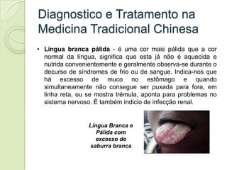 Diagnostico e Tratamento na
Medicina Tradicional Chinesa
• Língua branca pálida - é uma cor mais pálida que a cor
  normal...