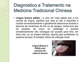 Diagnostico e Tratamento na
Medicina Tradicional Chinesa
• Língua branca pálida - é uma cor mais pálida que a cor
normal da língua, significa que esta já não é aquecida e
nutrida convenientemente e geralmente observa-se durante o
decurso de síndromes de frio ou de sangue. Indica-nos que
há excesso de muco no estômago e quando
simultaneamente não consegue ser puxada para fora, em
linha reta, ou se mostra trémula, aponta para problemas no
sistema nervoso. É também indicio de infecção renal.
Língua Branca e
Pálida com
excesso de
saburra branca
 