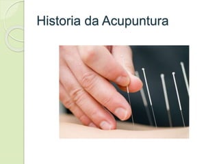 Historia da Acupuntura
 