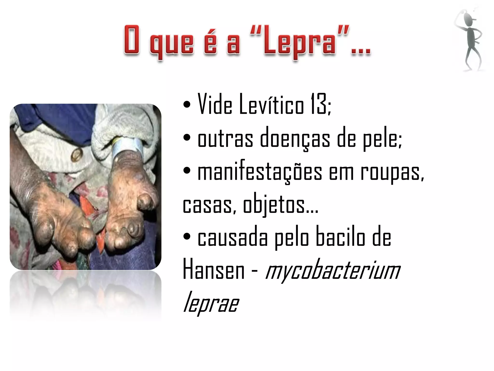 • Vide Levítico 13;
• outras doenças de pele;
• manifestações em roupas,
casas, objetos...
• causada pelo bacilo de
Hansen - mycobacterium
leprae
 