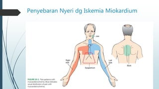 Penyebaran Nyeri dg Iskemia Miokardium
 