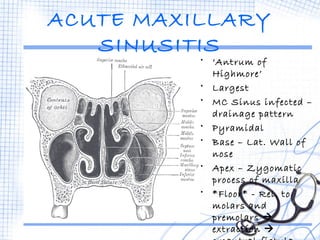 ACUTE MAXILLARY 
SINUSITIS 
• ‘Antrum of 
Highmore’ 
• Largest 
• MC Sinus infected – 
drainage pattern 
• Pyramidal 
• Base – Lat. Wall of 
nose 
• Apex – Zygomatic 
process of maxilla 
• *Floor* - Rel. to 
molars and 
premolars  
extraction  
oroantral fistula 
 