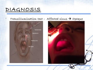 DIAGNOSIS 
• Transillumination test - Affected sinus  Opaque 
 