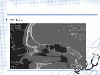 • CT Scan 
 