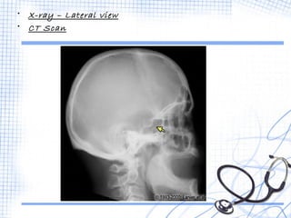 • X-ray – Lateral view 
• CT Scan 
 