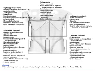 Acute Abdominal Pain