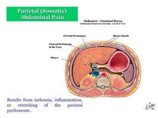 Acute Abdominal Pain
