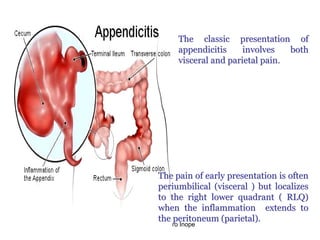 Acute Abdominal Pain