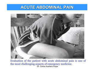 Acute Abdominal Pain