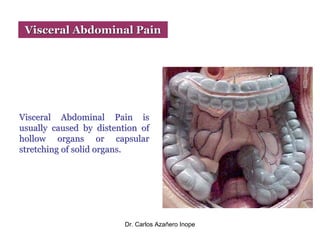 Acute Abdominal Pain PPT Acute Abdominal Pain PPT