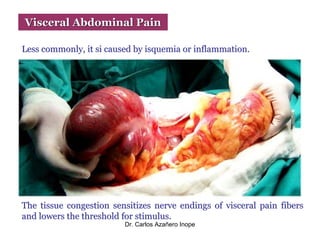 Acute Abdominal Pain