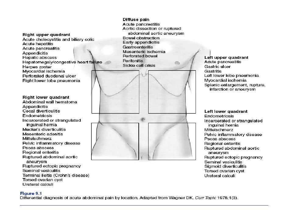 Acute Abdominal Pain