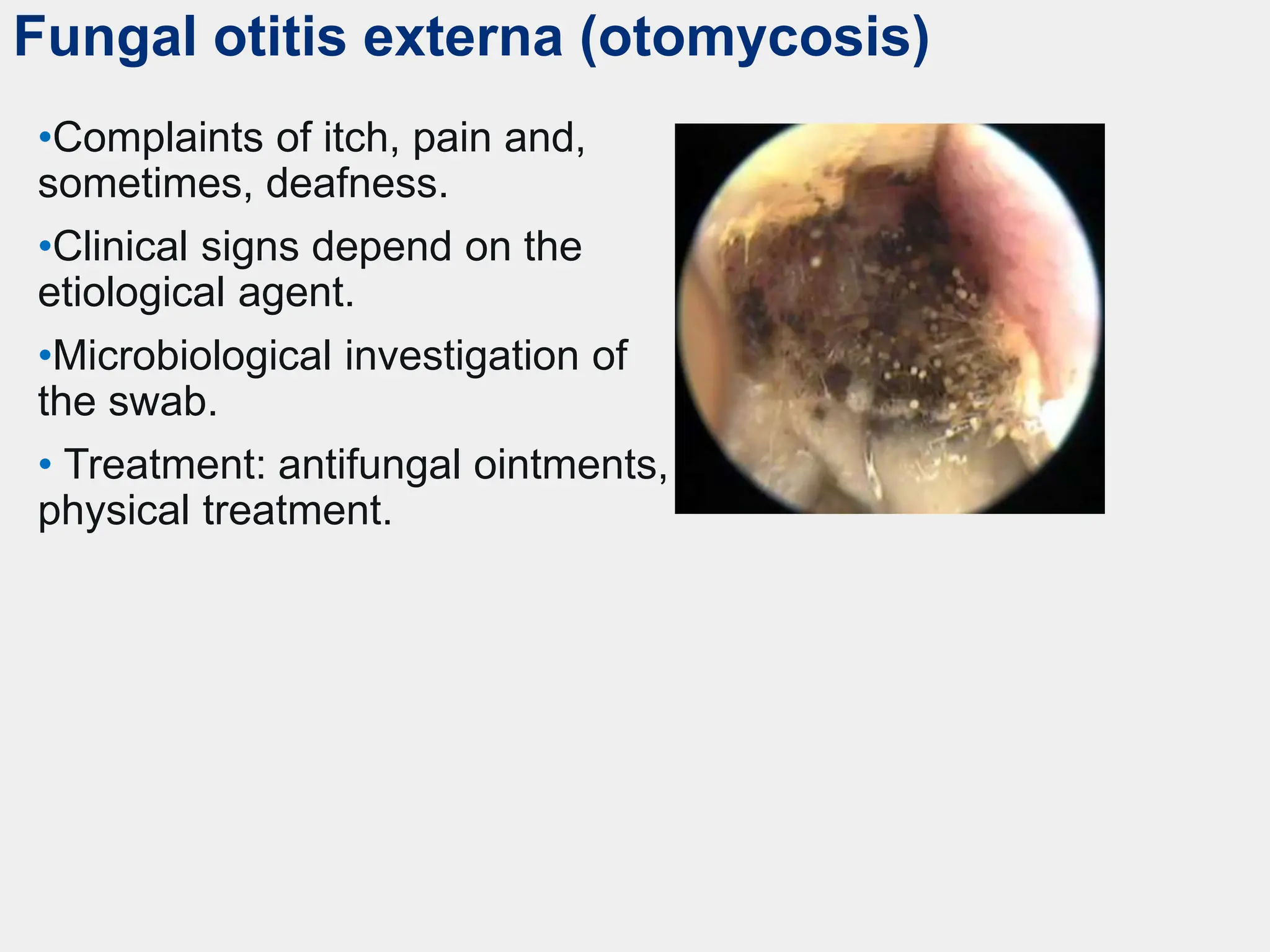Fungal otitis externa (otomycosis)
•Complaints of itch, pain and,
sometimes, deafness.
•Clinical signs depend on the
etiological agent.
•Microbiological investigation of
the swab.
• Treatment: antifungal ointments,
physical treatment.
 