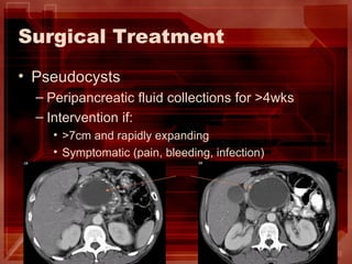 Surgical Treatment Pseudocysts Peripancreatic fluid collections for >4wks Intervention if: >7cm and rapidly expanding Symptomatic (pain, bleeding, infection) 