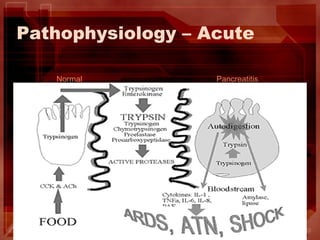 Pathophysiology – Acute  Normal Pancreatitis 
