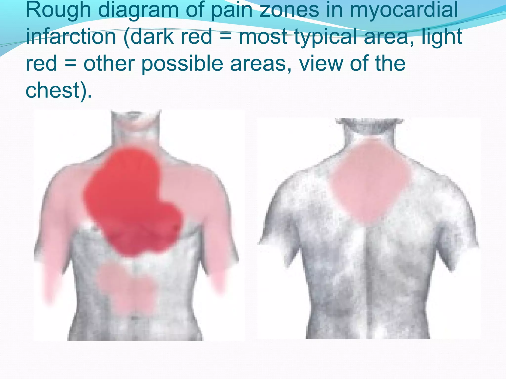 Rd Infraction Example Acute biological-crisis ppt lecture | PPT