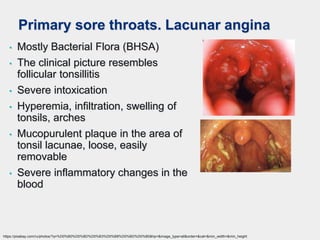 Primary sore throats. Lacunar angina
• Mostly Bacterial Flora (BHSA)
• The clinical picture resembles
follicular tonsillitis
• Severe intoxication
• Hyperemia, infiltration, swelling of
tonsils, arches
• Mucopurulent plaque in the area of
tonsil lacunae, loose, easily
removable
• Severe inflammatory changes in the
blood
https://pixabay.com/ru/photos/?q=%D0%B0%D0%BD%D0%B3%D0%B8%D0%BD%D0%B0&hp=&image_type=all&order=&cat=&min_width=&min_height
 