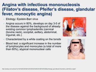 Angina with infectious mononucleosis
(Filatov’s disease, Pfeifer’s disease, glandular
fever, monocytic angina)
• Angina occurs in 80%, develops on day 3-5 of
the disease against the background of already
existing common lymphadenitis (cervical
(bovine neck), occipital, axillary, abdominal,
inguinal, etc.)
• Characterized by a white coating on the tonsils
• Blood test: a significant increase in the number
of lymphocytes and monocytes (a total of more
than 60%), atypical mononuclear cells
• Etiology: Epstein-Barr virus
https://pixabay.com/ru/photos/?q=%D0%B0%D0%BD%D0%B3%D0%B8%D0%BD%D0%B0&hp=&image_type=all&order=&cat=&min_width=&min_height=
 