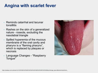 Angina with scarlet fever
• Reminds catarrhal and lacunar
tonsillitis
• Rashes on the skin of a generalized
nature - roseola, excluding the
nasolabial triangle
• Spilled hyperemia of the mucous
membrane of the oral cavity and
pharynx is a “flaming pharynx”,
which is replaced by plaques or
necrosis
• Language Changes - “Raspberry
Tongue”
https://pixabay.com/ru/photos/?q=%D0%B0%D0%BD%D0%B3%D0%B8%D0%BD%D0%B0&hp=&image_type=all&order=&cat=&min_
 