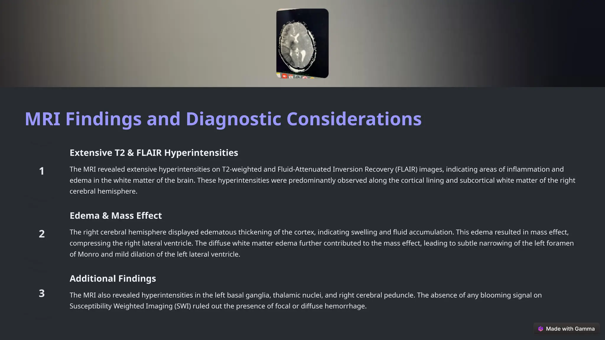 Acute-Disseminated-Encephalomyelitis-ADEM-A-Case-Report.pptx