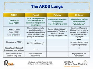 The ARDS Lungs Rouby JJ, et al. Eur Respir J. 2003. Rouby JJ, et al. Anesthesiology. 2004. Bilateral and diffuse hyperdensities “ White lungs” Bilateral and diffuse x-ray densities respecting lung apices Focal heterogeneous loss of aeration in caudal and dependent lung region Chest x-ray  (zero PEEP) Massive, diffuse and bilateral non- or poorly aerated lung regions – No normally aerated lung region Lower lobes massively nonaerated – The loss of aeration involves partially the upper lobes Upper lobes normally aerated despite a regional excess of lung tissue – Lower lobes poorly or non aerated Chest CT scan  (zero PEEP) Loss  of  aeration ++++ Lung recruitment curve Open lung concept ± PEEP <10-12 cmH 2 O Response to PEEP High potential for recruitment Low potential for recruitment Recruitment of non aerated lung unit ± ++++ Risk of overinflation of the aerated lung regions Diffuse Patchy Focal ARDS 