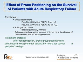 Effect of Prone Positioning on the Survival  of Patients with Acute Respiratory Failure Gattinoni L, et al. N Engl J Med. 2001. Enrollment: Oxygenation criteria Pao 2 /Fio 2    200 with a PEEP    5 cm H 2 O Pao 2 /Fio 2    300 with a PEEP    10 cm H 2 O Radiographic criteria Bilateral pulmonary infiltrates Pulmonary-capillary wedge pressure    18 mm Hg or the absence of  clinical evidence of left atrial hypertension. Treatment protocol: After randomization, prone group patients were  continuously kept prone for at least six hours per day for  a period of 10 days. 