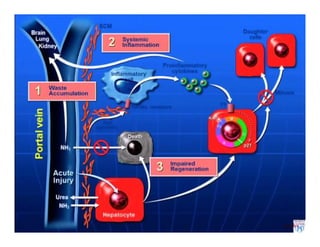 Acute on chronic liver failure | PDF
