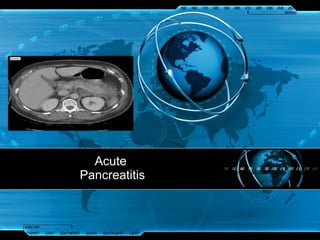 Acute  Pancreatitis 